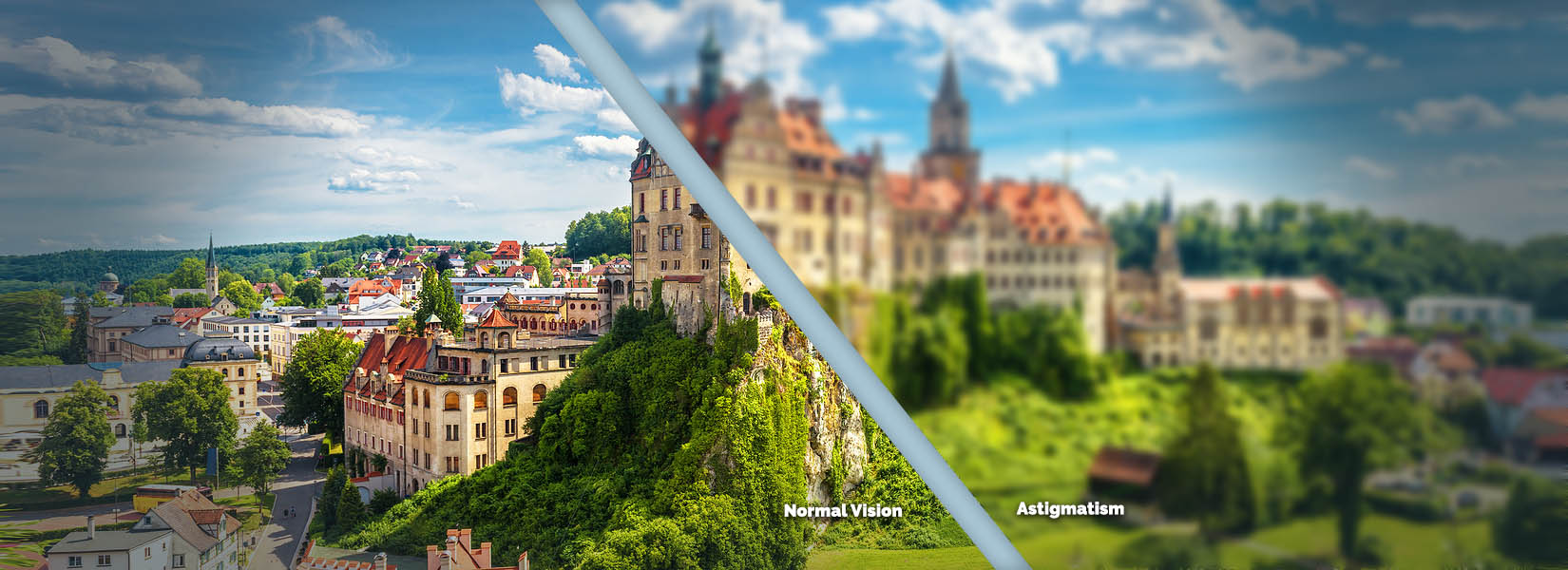 Astigmatism Treatment in Kent